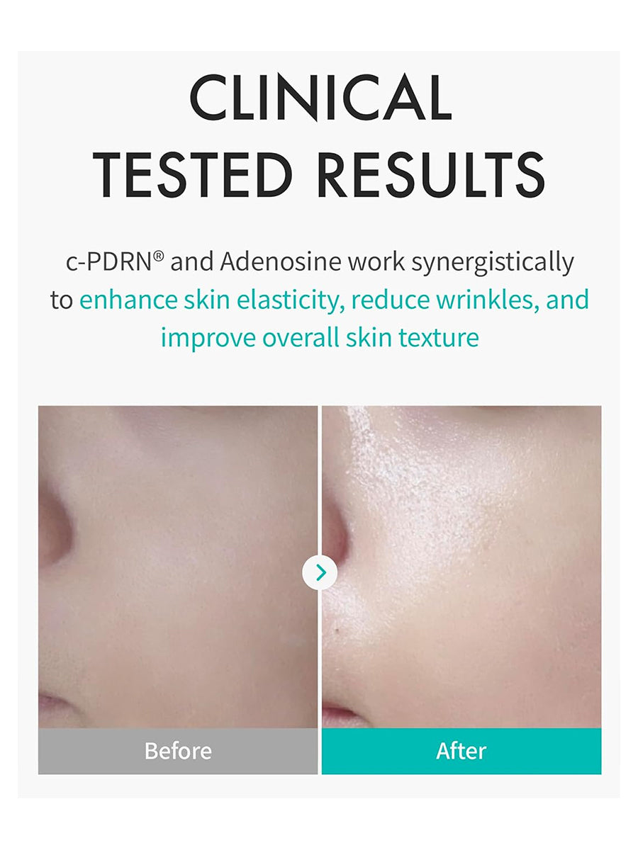 [REJURAN] Turnover Mask, c-PDRN (1Pcs Or 1Box(5Pcs)