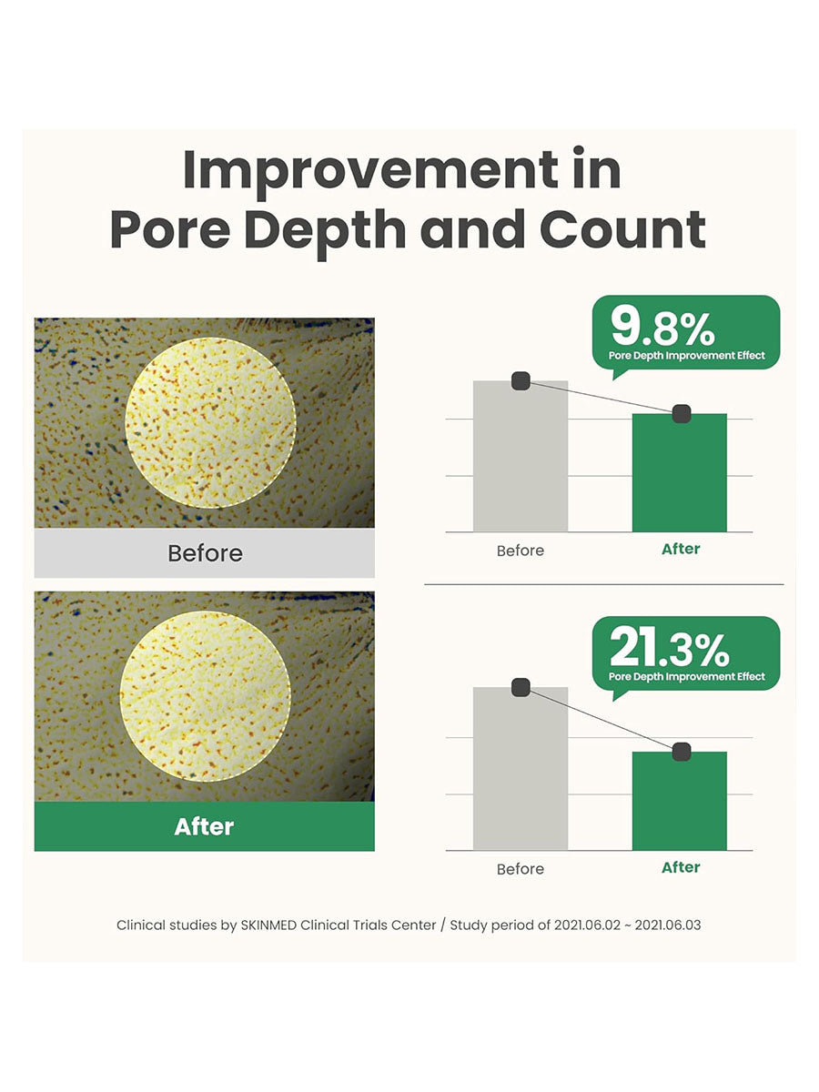 [AXIS-Y] Mugwort Pore Clarifying Wash Off Pack (100ml/3.38fl.oz)