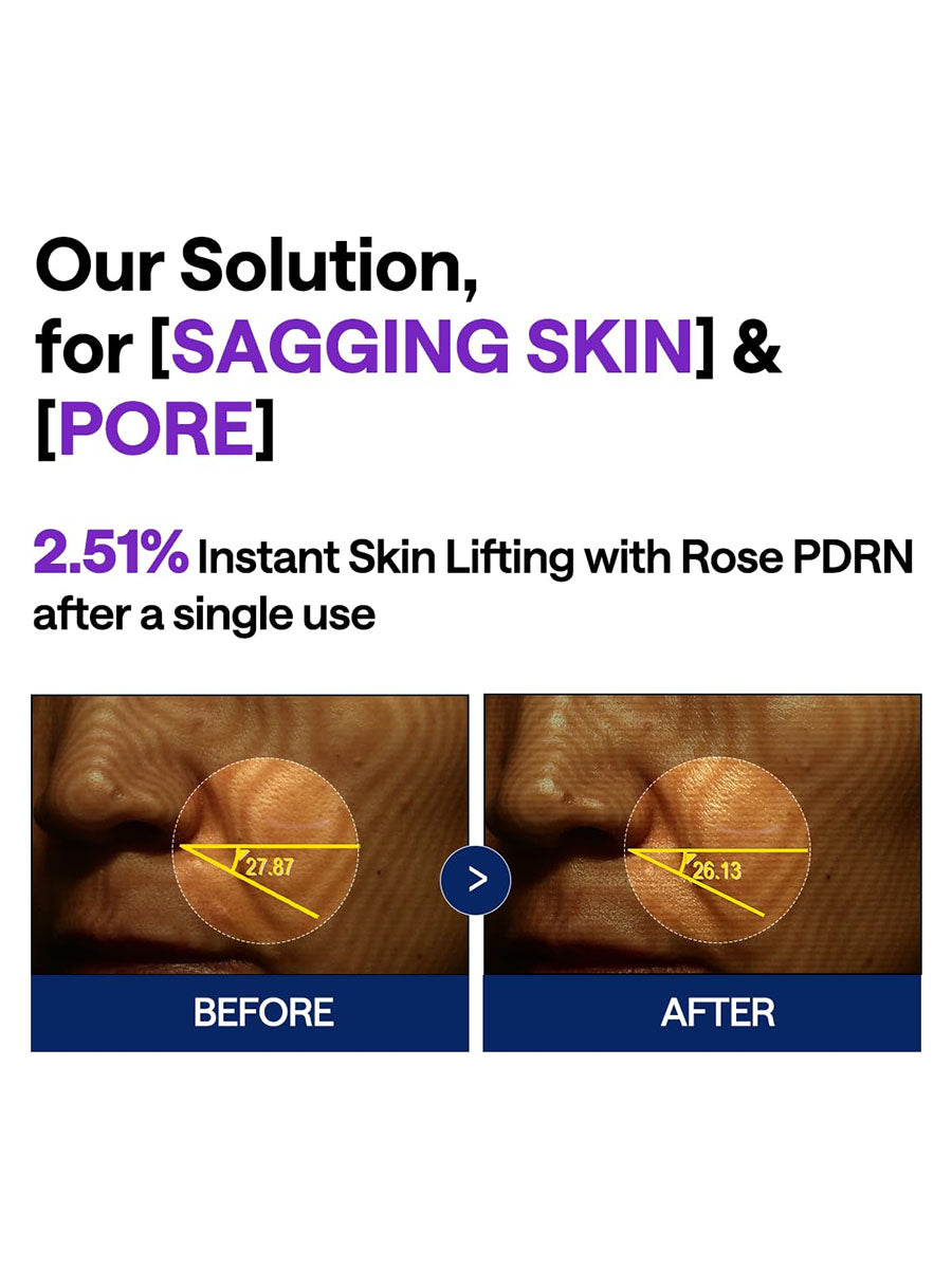 [Mediheal] PDRN Lifting Serum (40ml/1.35fl.oz)