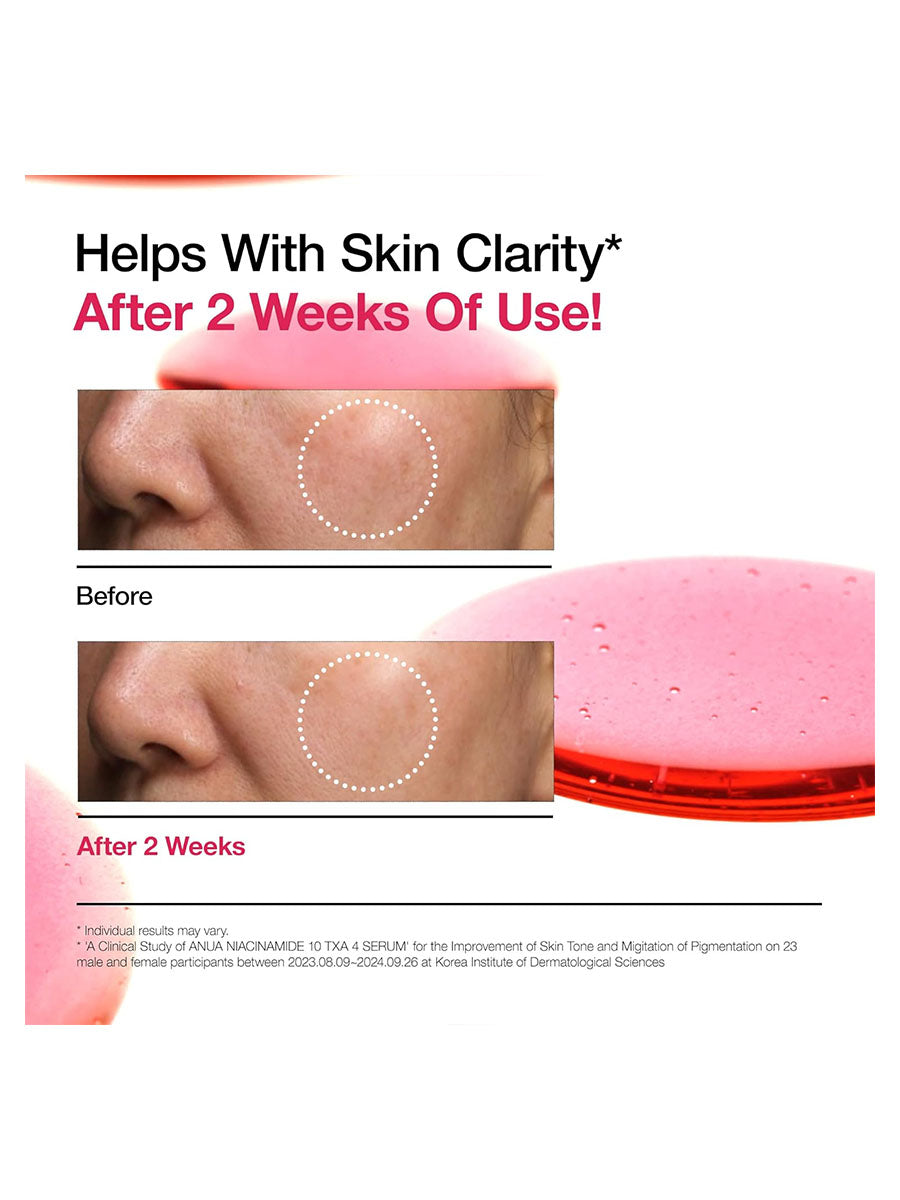 [Anua] Niacinamide 10% + TXA 4% Serum (30mL/1.01 fl.oz)
