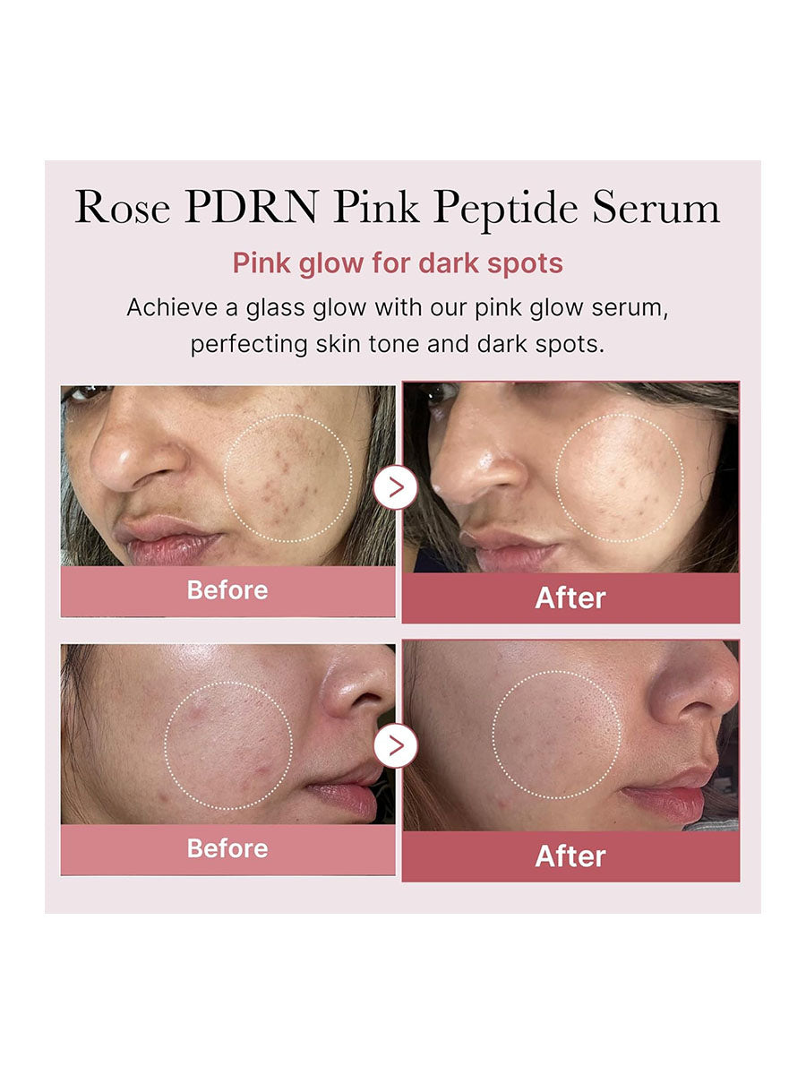 [medicube] PDRN Pink Peptide Serum (30ml/1.01fl.oz)
