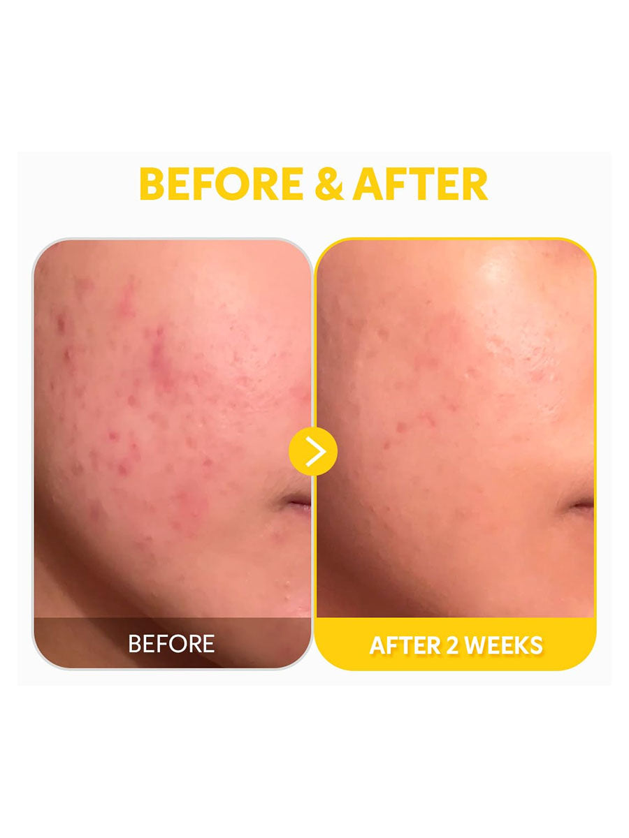 [TIRTIR] Pure Vitamin C24 Serum (30ml/1..01fl.oz)