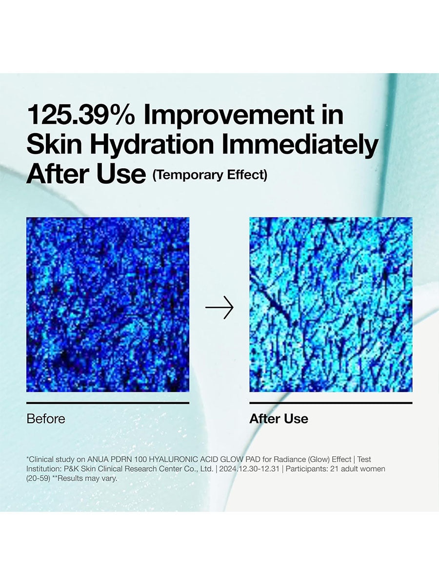 [Anua] PDRN 100 Hyaluronic Acid Pad (60Pads)